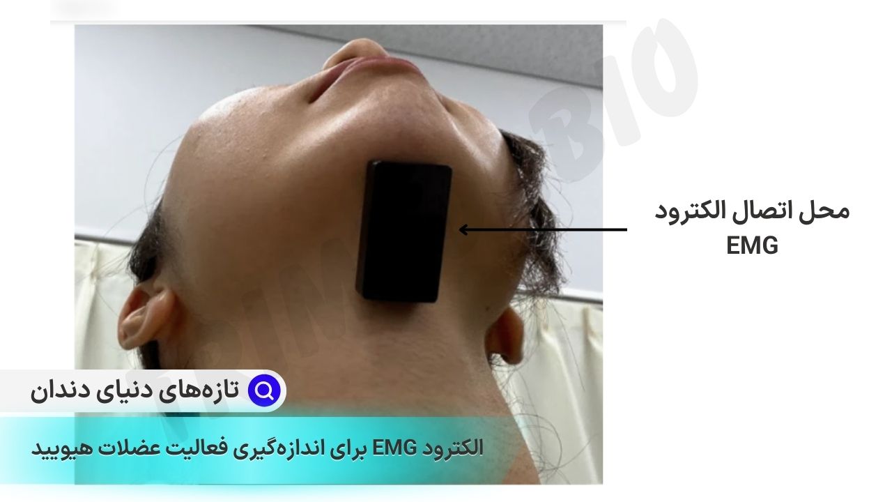 تاثیر مسواک زدن روی بهبود تنفس سامندان