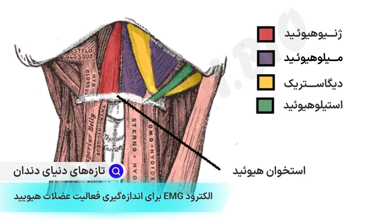 استخوان لامی یا استخوان هیوئید