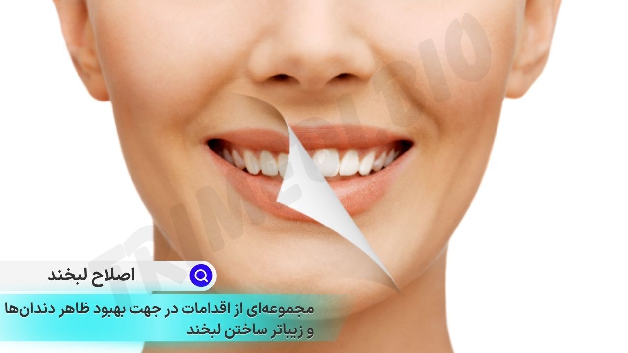 همه چیز درباره اصلاح لبخند