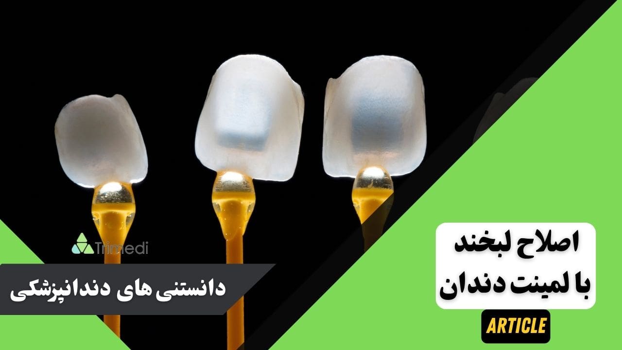 همه چیز در مورد لمینت دندان