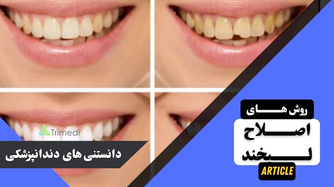 همه چیز درباره اصلاح لبخند