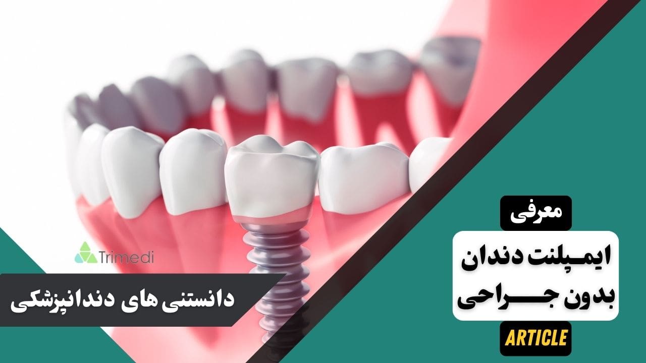 ایمپلنت دندان بدون جراحی